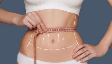 Абдомінопластика чи ліпосакція: Що обрати для похудіння?